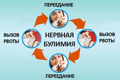 Лечение булимии в Луховицах